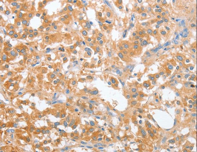 OX2R / Orexin Receptor 2 Antibody