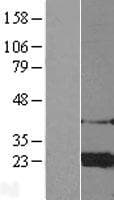 Human ARF4 Protein (Over-Expression Lysate Myc-DDK (Flag))