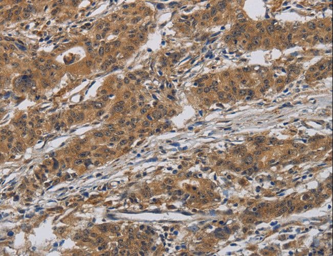 INPPL1 / SHIP2 Antibody