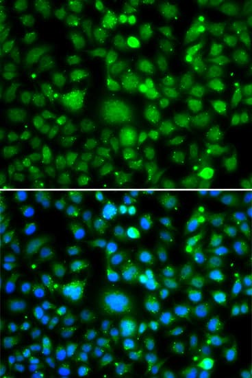 IHC-plus™ TEK / TIE2 Antibody