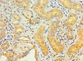 TRAIL-R4 / DCR2 Antibody (aa257-386)