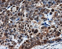 PSMC3 Antibody (clone OTI8D6)