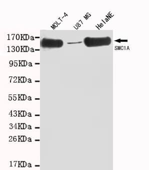 Monoclonal Mouse anti-Human SMC1A / SMC1 Antibody (C-Terminus, WB)