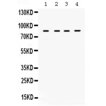 Polyclonal Rabbit anti-Human TGFBR2 Antibody (aa96-128, WB)