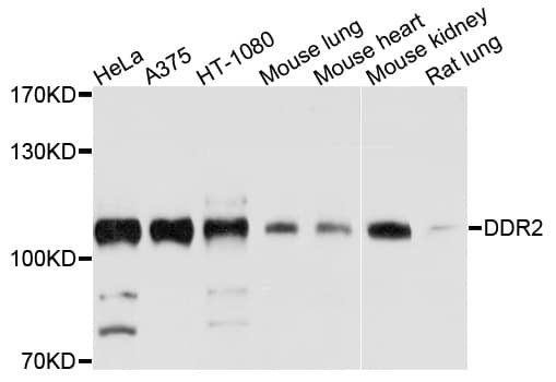DDR2 Antibody
