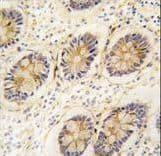 AKR1B1 / Aldose Reductase Antibody (aa290-316)