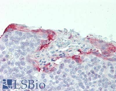 IHC-plus™ FLCN / Folliculin Antibody (aa1-50)