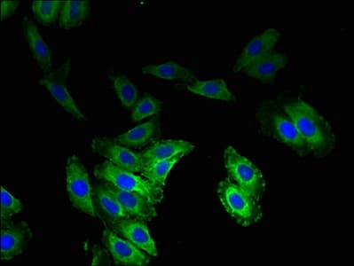 VOPP1 / ECOP Antibody