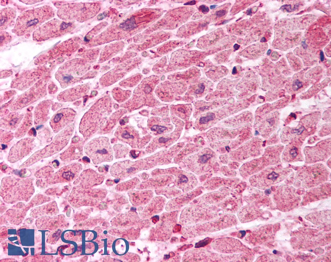 IHC-plus™ Polyclonal Rabbit anti-Human TICAM1 / TRIF Antibody (C-Terminus, IHC, WB)