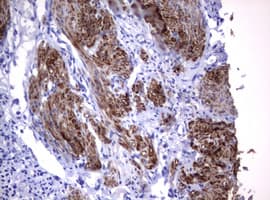 Monoclonal Mouse anti-Human CD30 Antibody (clone OTI9H7, IHC, WB)
