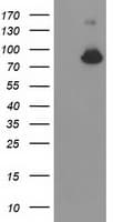 ACSS2 / ACAS2 Antibody (clone OTI2E10, Carrier-free)