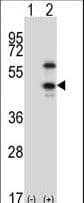 CDKL1 Antibody (aa285-316)