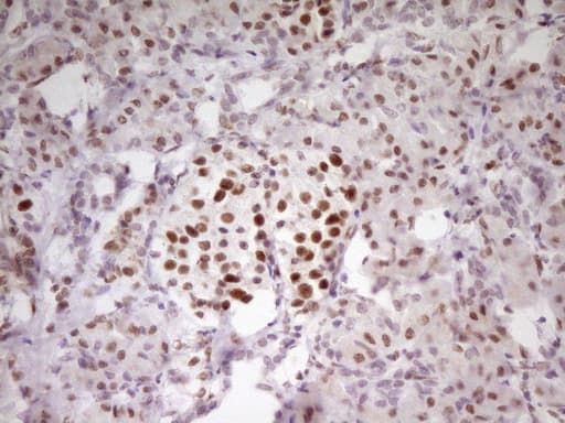 MEF2D Antibody (aa1-282, clone OTI10B4, Carrier-free)