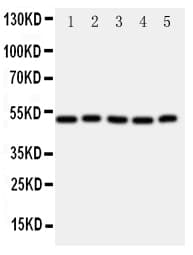 ALDH3A1 Antibody (aa440-453)