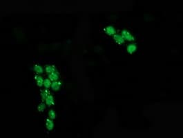 Monoclonal Mouse anti-Human TP53 / p53 Antibody (clone OTI3F5, IHC, IF, WB)