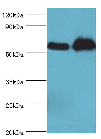 RALDH2 / ALDH1A2 Antibody (aa1-180)