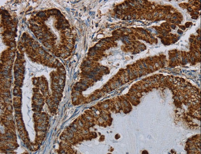 HSD17B2 Antibody