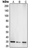 TOLLIP Antibody (Internal)