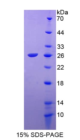 Human FGF18 Protein (Recombinant His-T7)