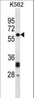 NMT2 Antibody (aa125-153)