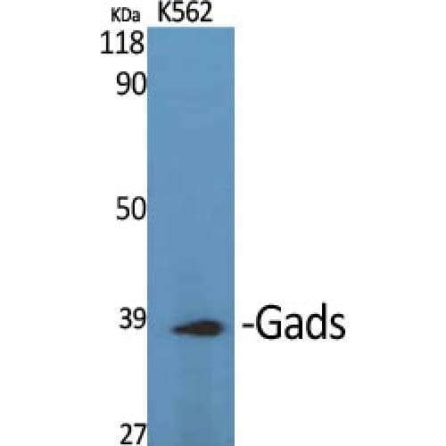 GRAP2 / GRID Antibody (90-170 aa, Internal)