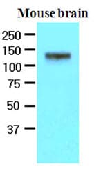 IHC-plus™ EPHA2 / EPH Receptor A2 Antibody (aa559-976, clone 3D7)
