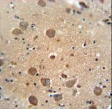 Polyclonal Rabbit anti-Human C6orf62 Antibody (aa118-147, IHC, WB)