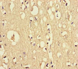 DOCK6 Antibody