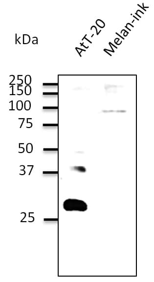 IHC-plus™ RAB27B Antibody (C-Terminus)