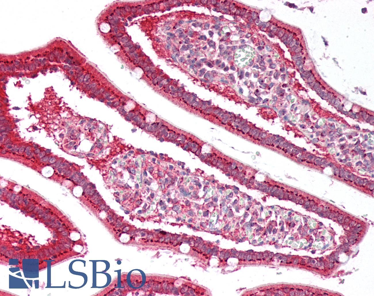 IHC-plus™ MAN2A1 / Mannosidase II Antibody (aa865-1144)