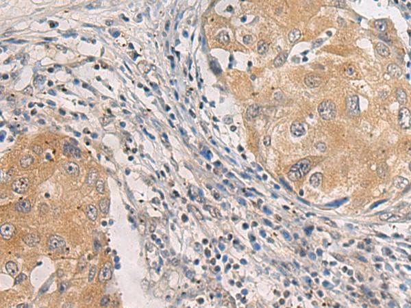 AGAP3 / CENTG3 / MRIP-1 Antibody