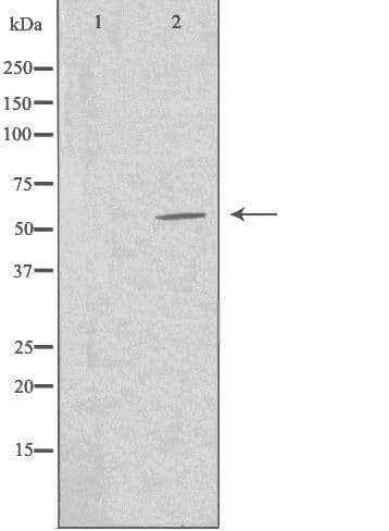 TFB1 / GTF2H1 Antibody