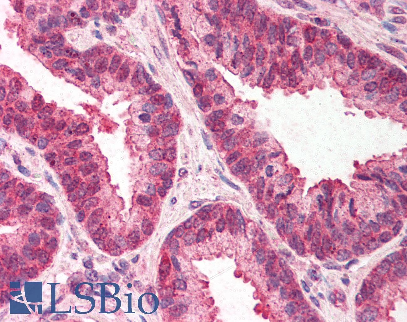 IHC-plus™ TMED10 / TMP21 Antibody