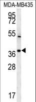 Polyclonal Rabbit anti-Human TNIP3 Antibody (aa74-102, IHC, WB)