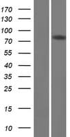 DQX1 Protein (Over-Expression Lysate Myc-DDK (Flag))