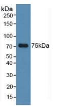 MAPT / Tau Antibody (aa130-386)