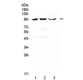 CD105 Antibody