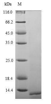 Pig PTH / Parathyroid Hormone Protein (Recombinant 6His, N-terminus)