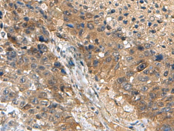 Polyclonal Rabbit anti-Human TPD52L3 Antibody (IHC)