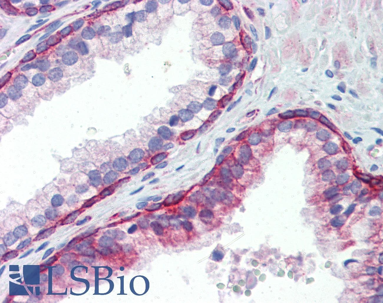 UBE2L3 / UBCH7 Antibody (C-Terminus)