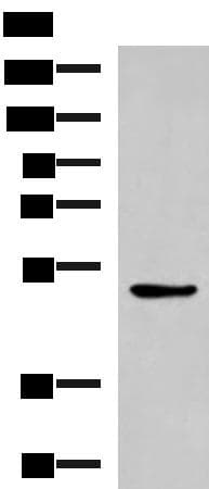 BLNK Antibody