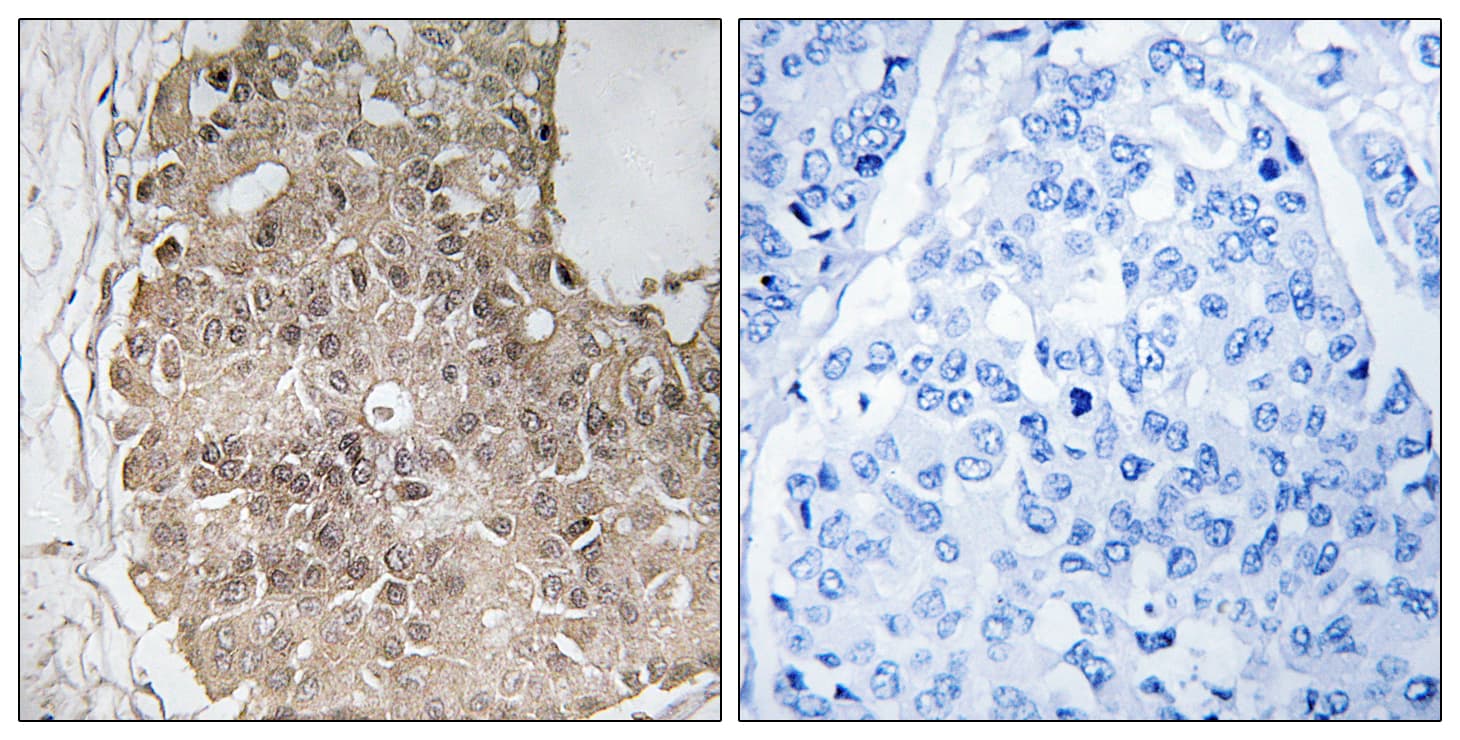 PARP4 / VPARP Antibody (aa1151-1200)