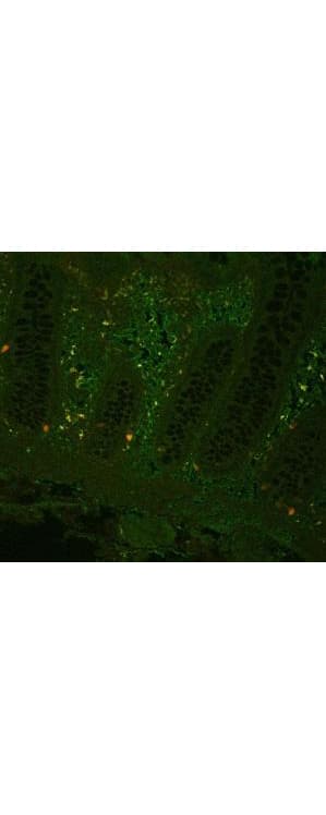 Polyclonal Rabbit anti-Human TNF Alpha Antibody (IHC, IF, WB)