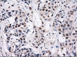 Monoclonal Mouse anti-Human PSMD10 / Gankyrin Antibody (clone OTI3F6, WB)