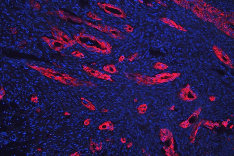 KRT18 / CK18 / Cytokeratin 18 Antibody