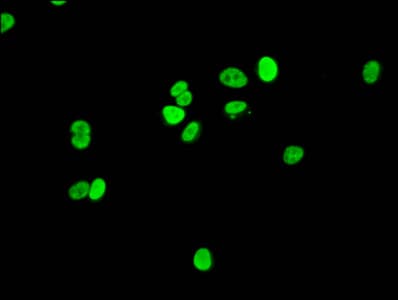 HIST1H1E Antibody (phospho-Thr145)