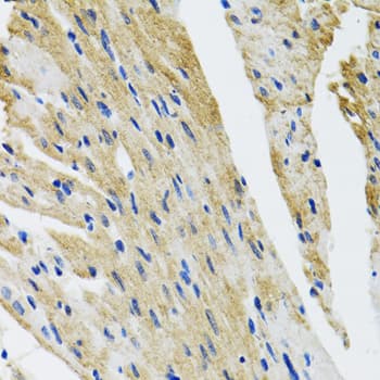 Polyclonal Rabbit anti-Human COPB2 / Beta-COP Antibody (IHC, IF, WB)