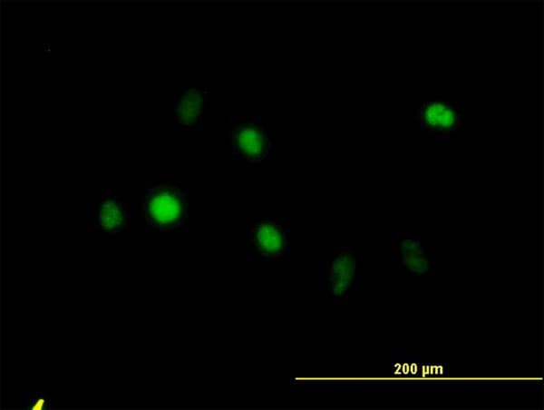 IHC-plus™ Monoclonal Mouse anti-Human ANXA5 / Annexin V Antibody (clone 1F4-1A5, IHC, IF, WB)
