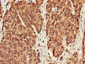 Polyclonal Rabbit anti-Human PPP1CB Antibody (IHC, WB)