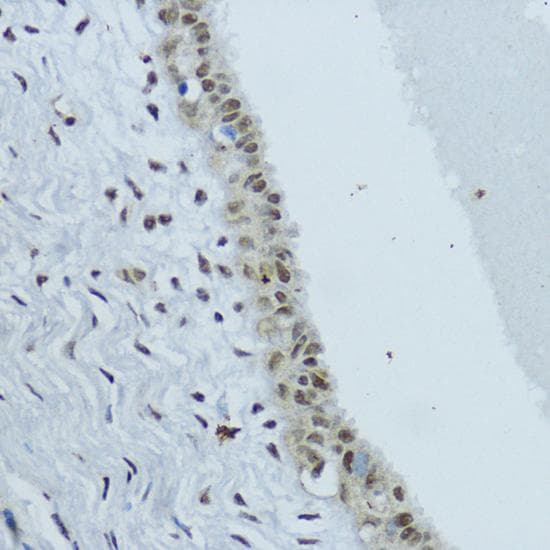 NR1I3 / CAR Antibody